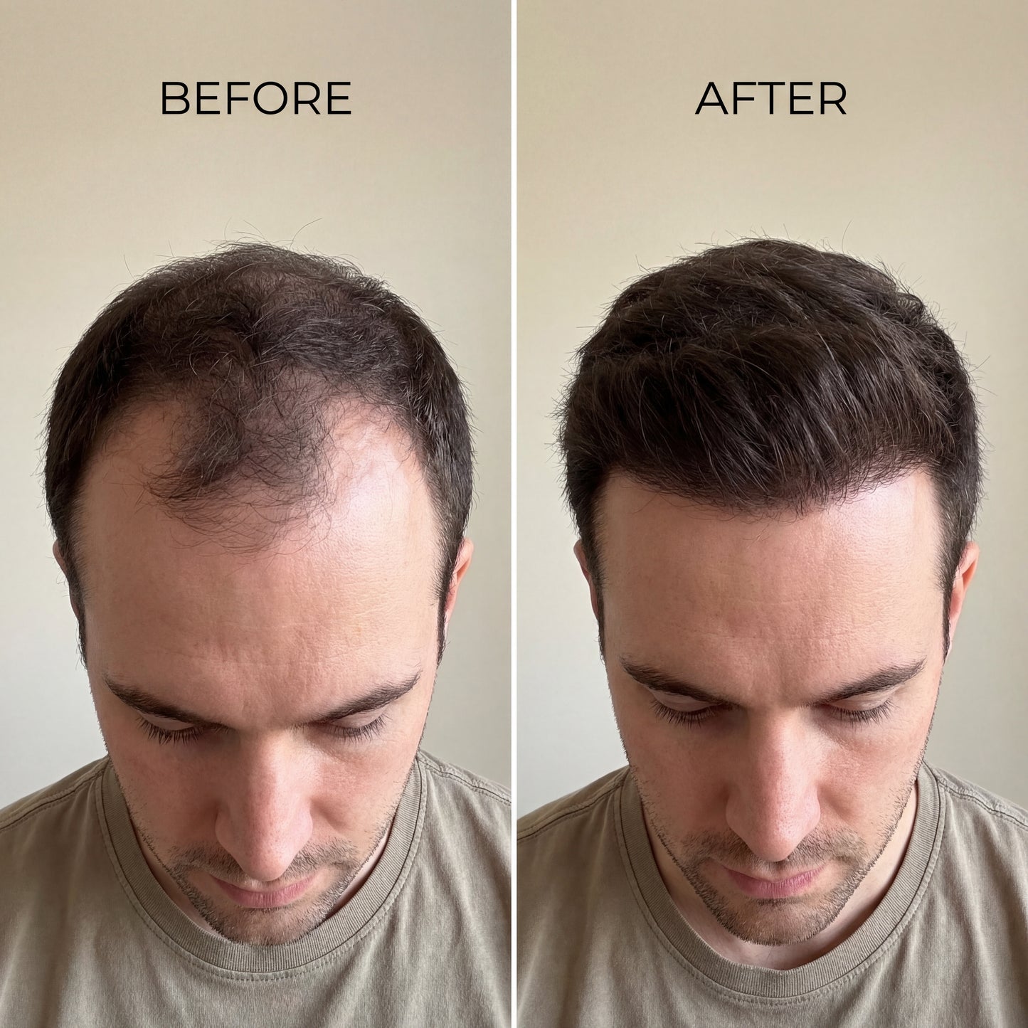 REWELL - Hair Growth Serum