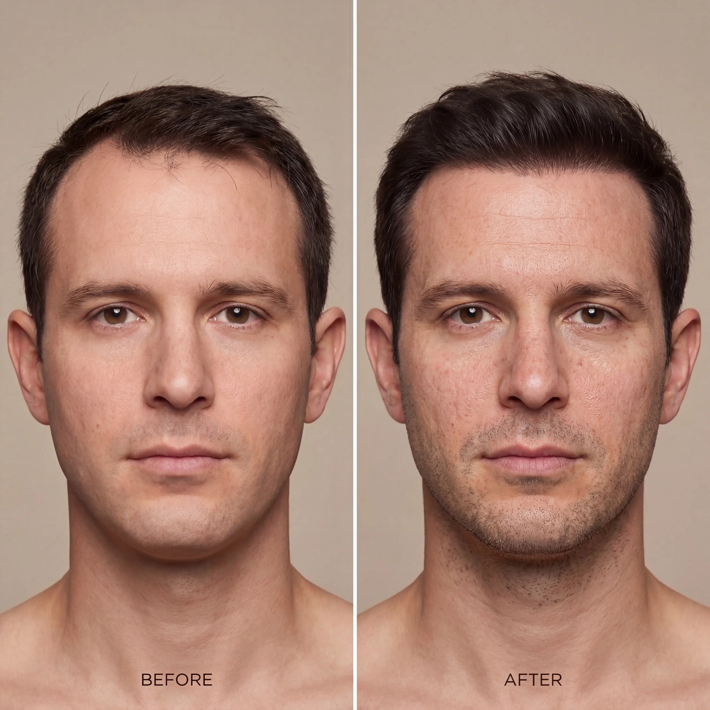 REWELL - Hair Growth Serum