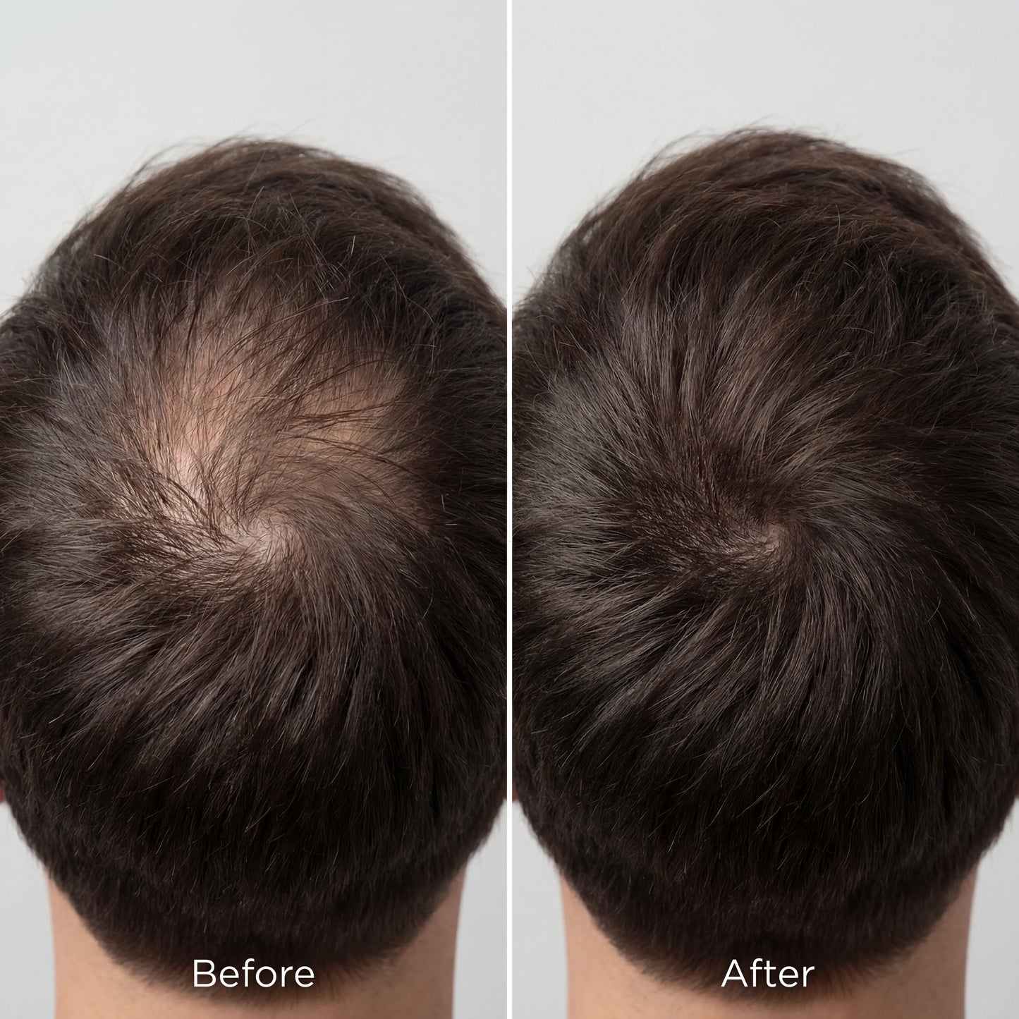 REWELL - Hair Growth Serum