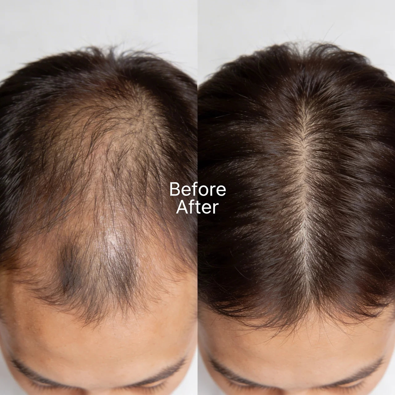 REWELL - Hair Growth Serum